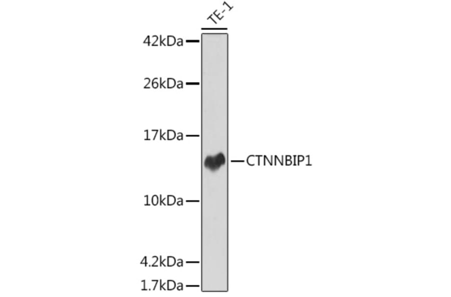 Western Blot - Anti-CTNNBIP1/ICAT Antibody [ARC2551] (A307577) - Antibodies.com