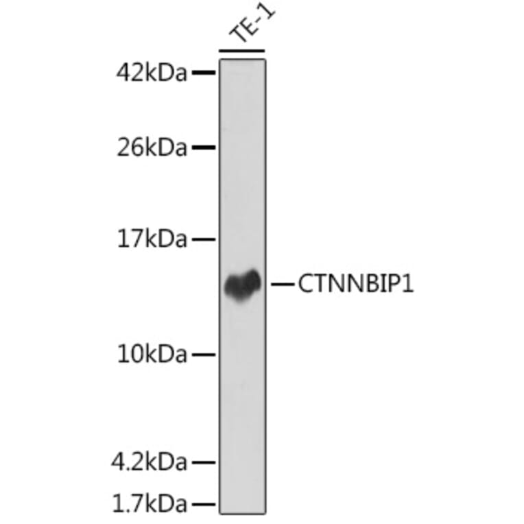 Western Blot - Anti-CTNNBIP1/ICAT Antibody [ARC2551] (A307577) - Antibodies.com