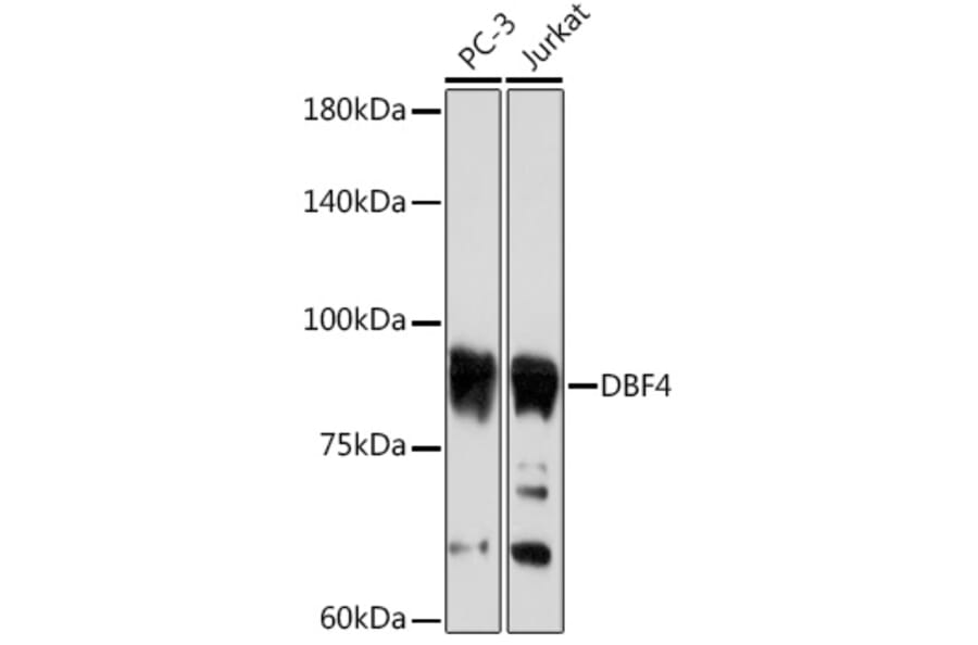 Western Blot - Anti-DBF4 Antibody [ARC2293] (A307578) - Antibodies.com