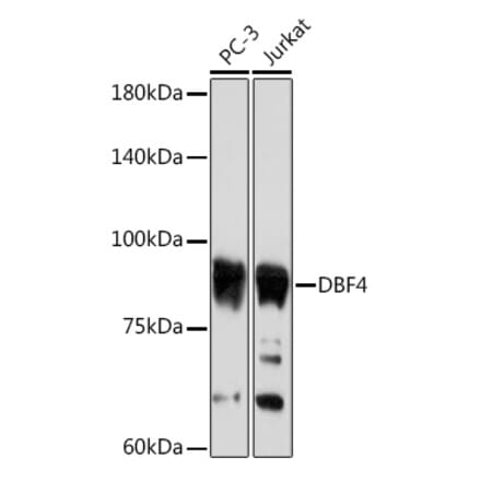 Western Blot - Anti-DBF4 Antibody [ARC2293] (A307578) - Antibodies.com