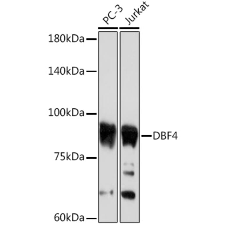 Western Blot - Anti-DBF4 Antibody [ARC2293] (A307578) - Antibodies.com