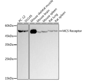 Western Blot - Anti-MC-2 Antibody [ARC2739] (A307579) - Antibodies.com