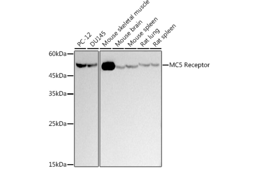 Western Blot - Anti-MC-2 Antibody [ARC2739] (A307579) - Antibodies.com