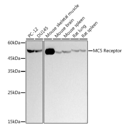 Western Blot - Anti-MC-2 Antibody [ARC2739] (A307579) - Antibodies.com