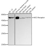 Western Blot - Anti-MC-2 Antibody [ARC2739] (A307579) - Antibodies.com