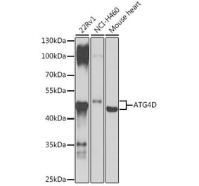 Western Blot - Anti-ATG4D Antibody (A307580) - Antibodies.com