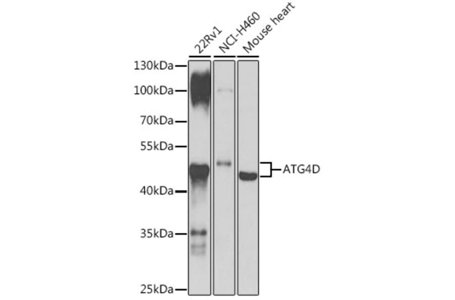 Western Blot - Anti-ATG4D Antibody (A307580) - Antibodies.com