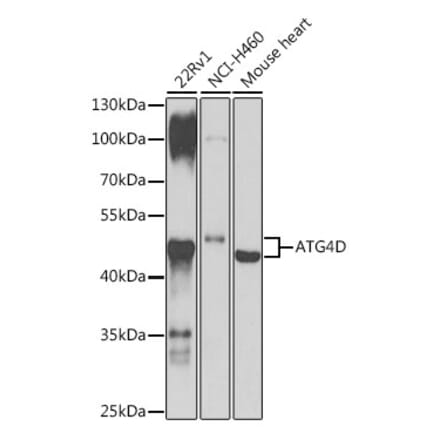 Western Blot - Anti-ATG4D Antibody (A307580) - Antibodies.com