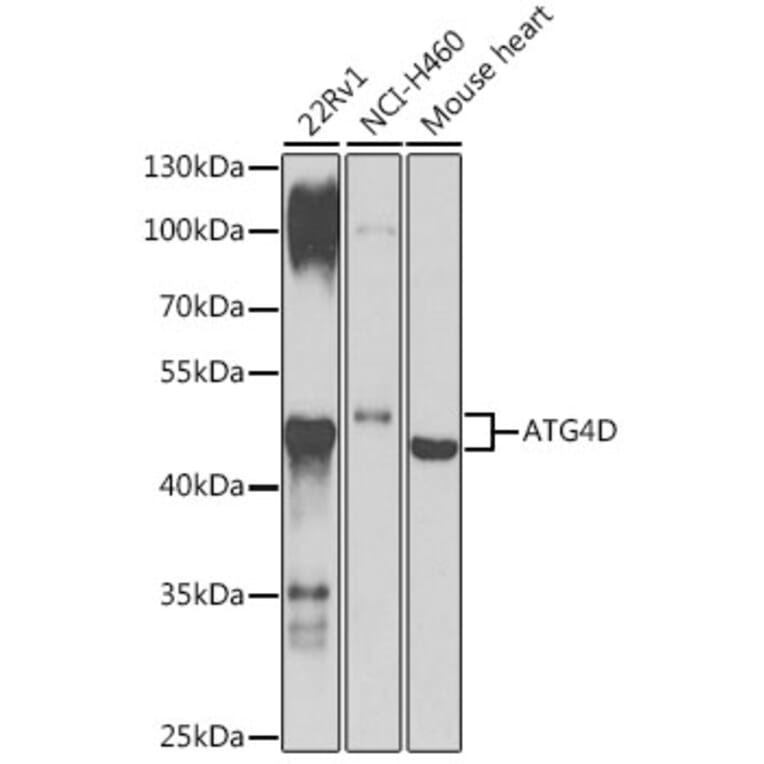 Western Blot - Anti-ATG4D Antibody (A307580) - Antibodies.com