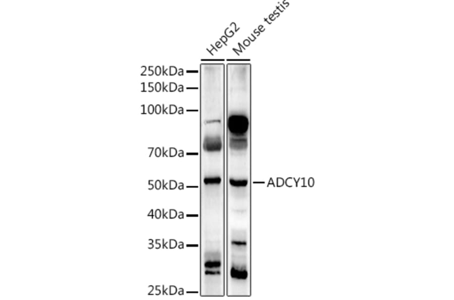 Western Blot - Anti-ADCY10/SAC Antibody (A307581) - Antibodies.com