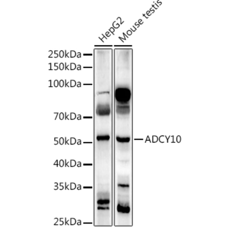 Western Blot - Anti-ADCY10/SAC Antibody (A307581) - Antibodies.com