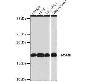 Western Blot - Anti-Prostate Secretory Protein/PSP Antibody [ARC0912] (A307582) - Antibodies.com