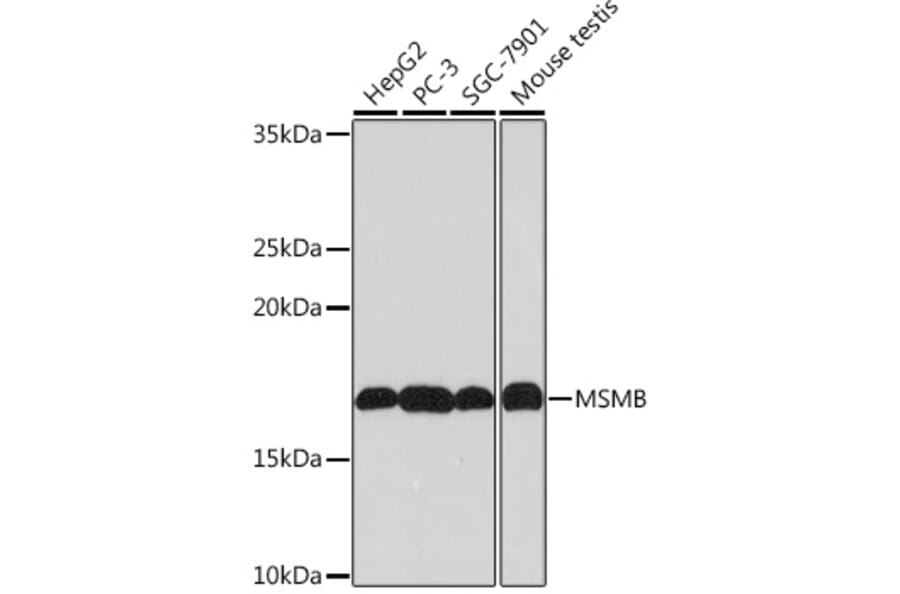 Western Blot - Anti-Prostate Secretory Protein/PSP Antibody [ARC0912] (A307582) - Antibodies.com