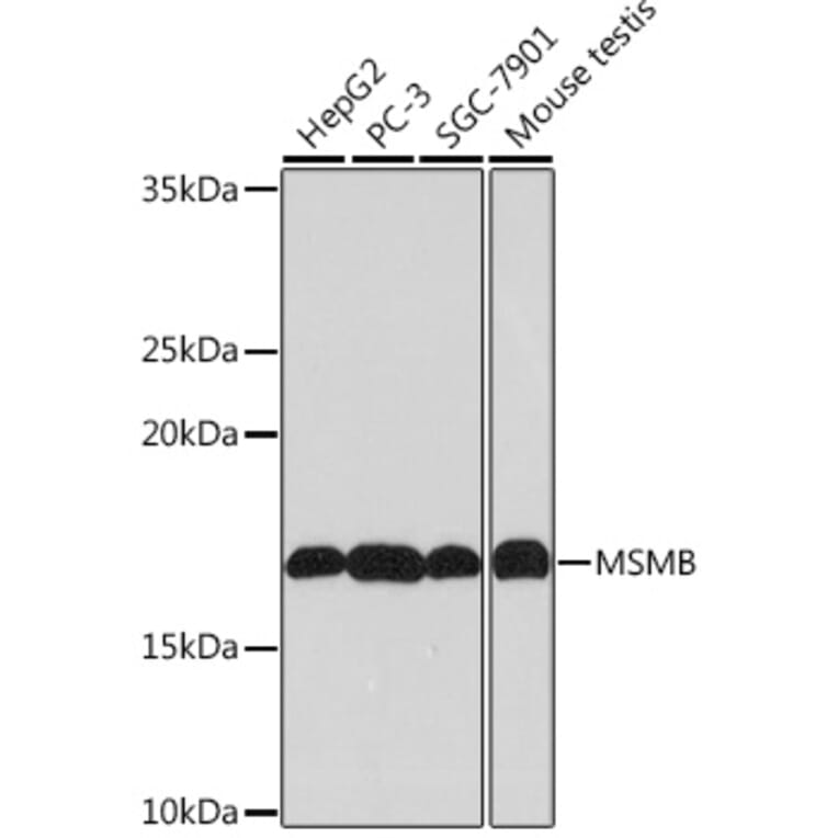 Western Blot - Anti-Prostate Secretory Protein/PSP Antibody [ARC0912] (A307582) - Antibodies.com
