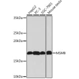 Western Blot - Anti-Prostate Secretory Protein/PSP Antibody [ARC0912] (A307582) - Antibodies.com