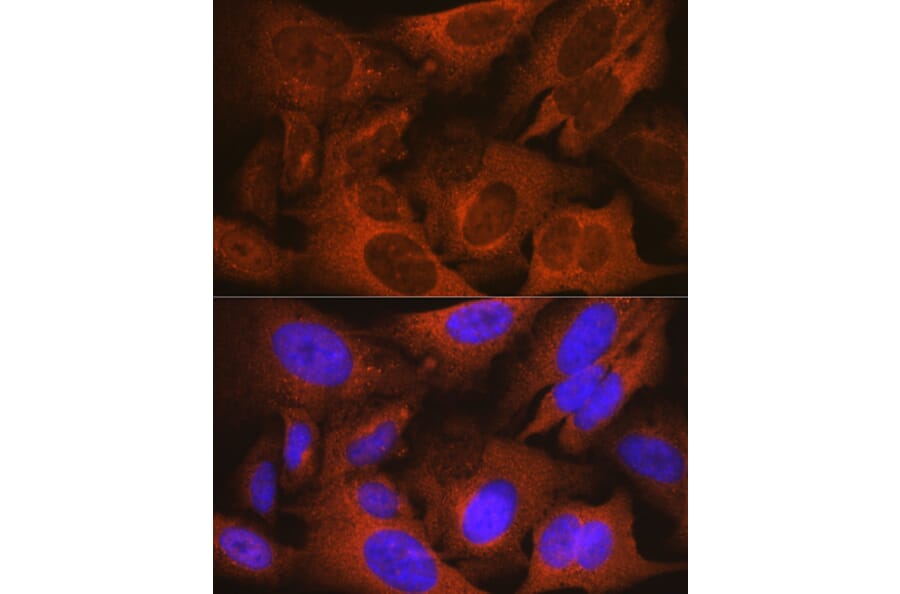Immunofluorescence - Anti-Prostate Secretory Protein/PSP Antibody [ARC0912] (A307582) - Antibodies.com