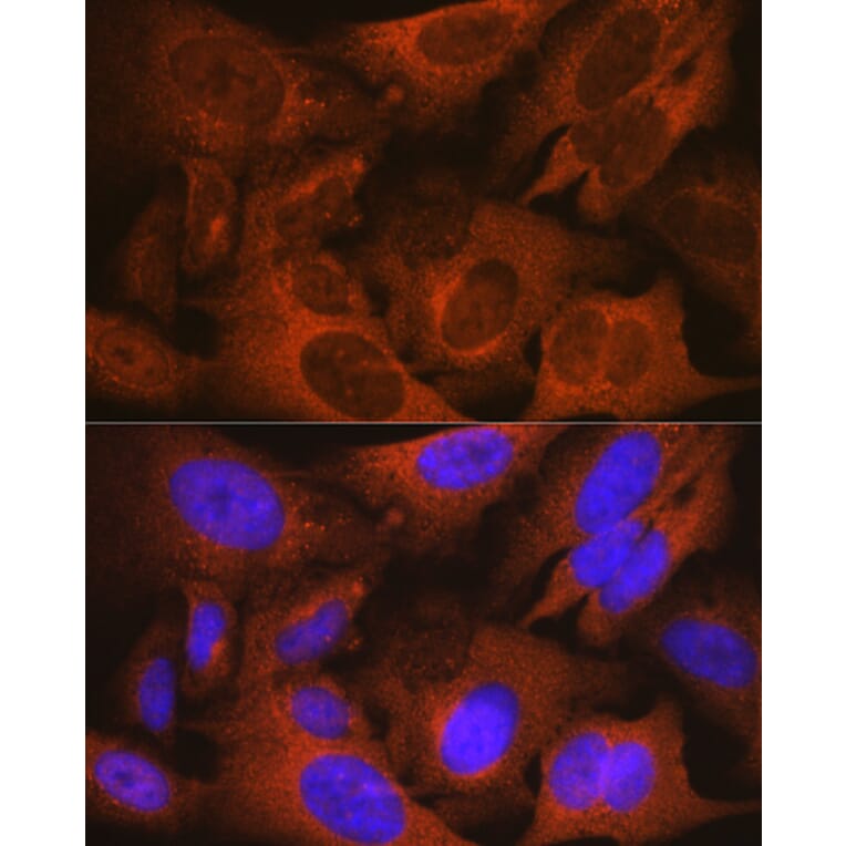 Immunofluorescence - Anti-Prostate Secretory Protein/PSP Antibody [ARC0912] (A307582) - Antibodies.com