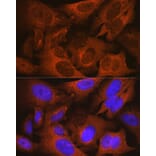 Immunofluorescence - Anti-Prostate Secretory Protein/PSP Antibody [ARC0912] (A307582) - Antibodies.com