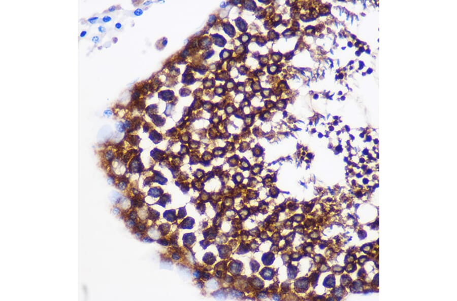 Immunohistochemistry - Anti-Prostaglandin E Synthase/MPGES-1 Antibody (A307583) - Antibodies.com