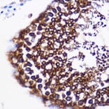 Immunohistochemistry - Anti-Prostaglandin E Synthase/MPGES-1 Antibody (A307583) - Antibodies.com