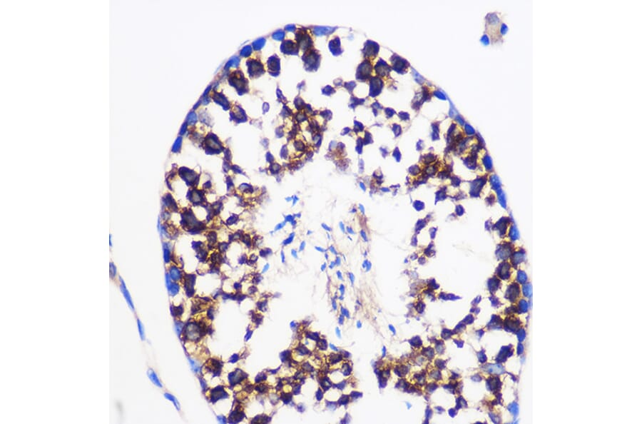 Immunohistochemistry - Anti-Prostaglandin E Synthase/MPGES-1 Antibody (A307583) - Antibodies.com