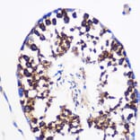 Immunohistochemistry - Anti-Prostaglandin E Synthase/MPGES-1 Antibody (A307583) - Antibodies.com
