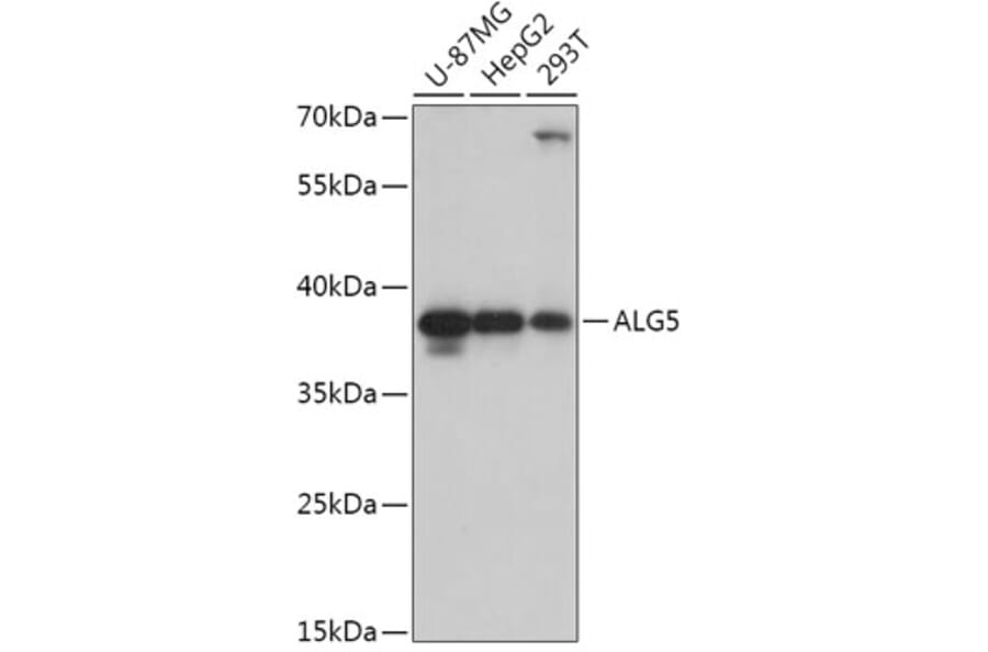 Western Blot - Anti-ALG5 Antibody (A307584) - Antibodies.com