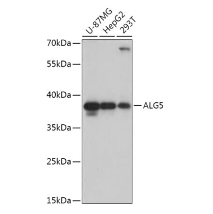 Western Blot - Anti-ALG5 Antibody (A307584) - Antibodies.com