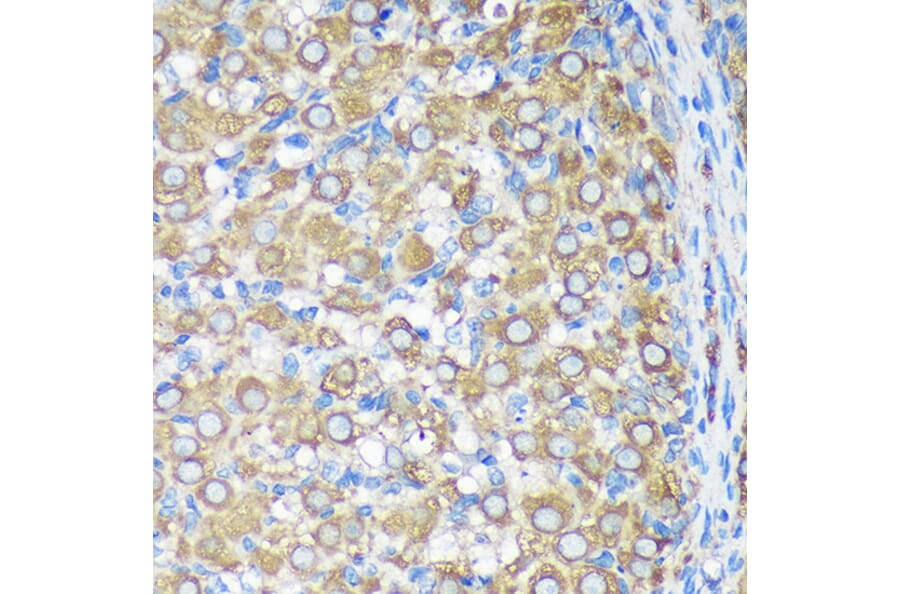 Immunohistochemistry - Anti-ALG5 Antibody (A307584) - Antibodies.com