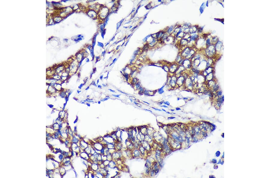 Immunohistochemistry - Anti-ALG5 Antibody (A307584) - Antibodies.com