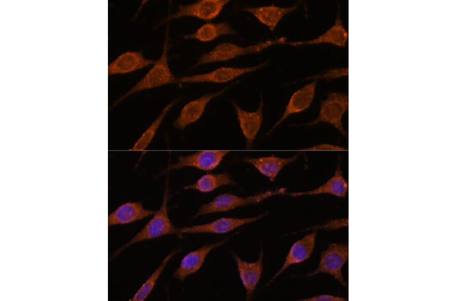 Immunofluorescence - Anti-ALG5 Antibody (A307584) - Antibodies.com