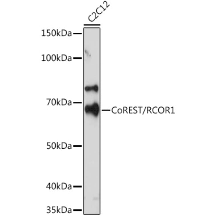 Western Blot - Anti-CoREST Antibody [ARC2044] (A307585) - Antibodies.com