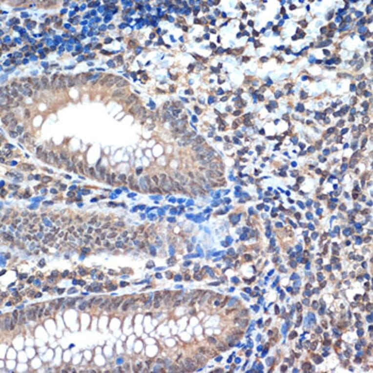 Immunohistochemistry - Anti-CoREST Antibody [ARC2044] (A307585) - Antibodies.com
