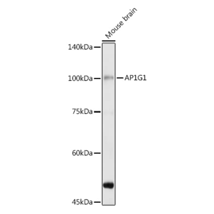 Western Blot - Anti-gamma Adaptin Antibody (A307586) - Antibodies.com