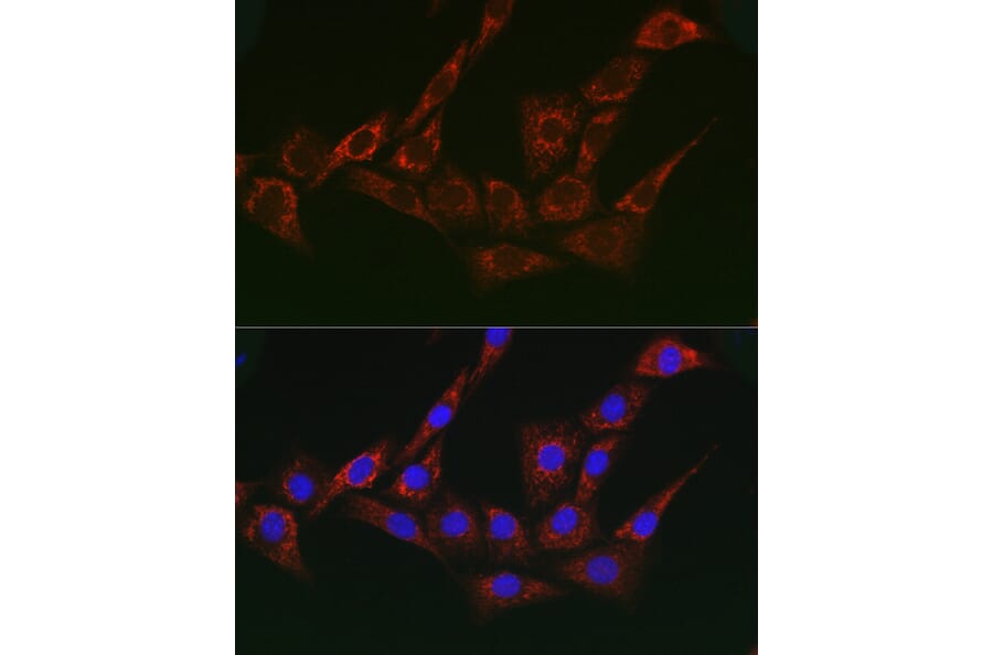 Immunofluorescence - Anti-gamma Adaptin Antibody (A307586) - Antibodies.com