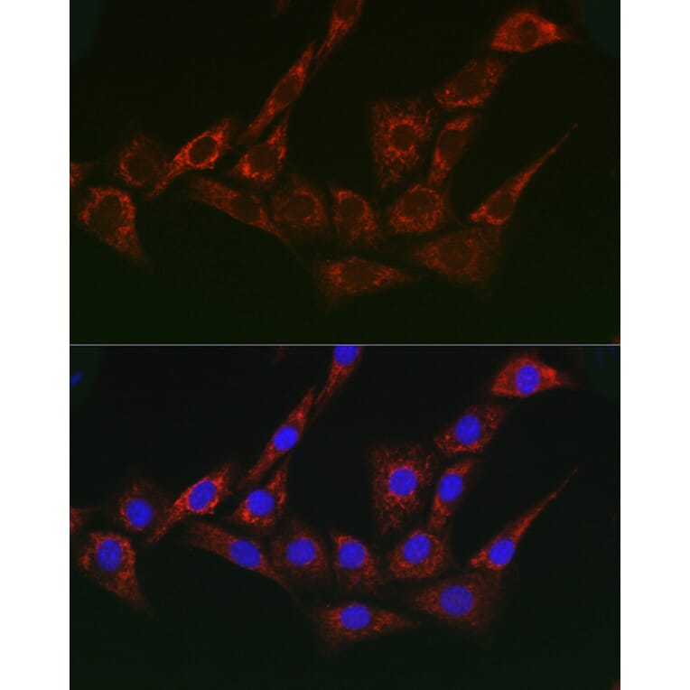 Immunofluorescence - Anti-gamma Adaptin Antibody (A307586) - Antibodies.com