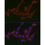 Immunofluorescence - Anti-gamma Adaptin Antibody (A307586) - Antibodies.com