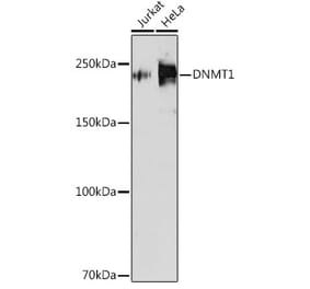Western Blot - Anti-Dnmt1 Antibody [ARC51348] (A307587) - Antibodies.com