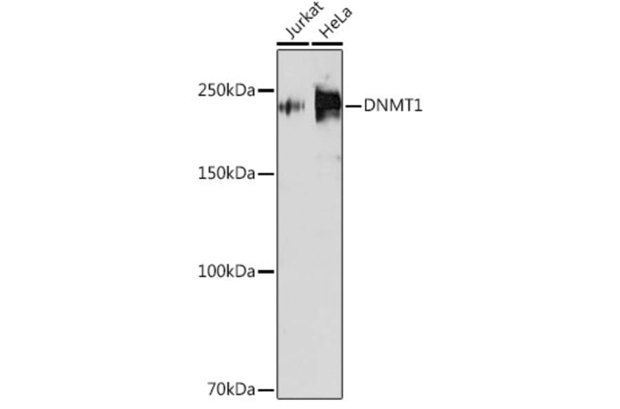 Western Blot - Anti-Dnmt1 Antibody [ARC51348] (A307587) - Antibodies.com