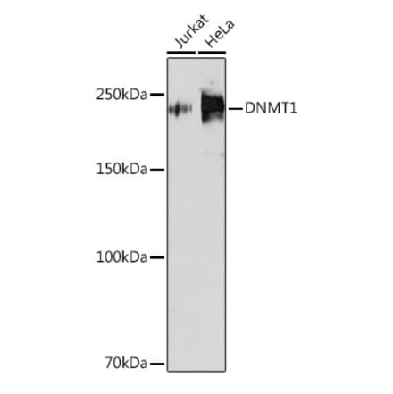 Western Blot - Anti-Dnmt1 Antibody [ARC51348] (A307587) - Antibodies.com