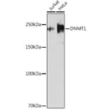 Western Blot - Anti-Dnmt1 Antibody [ARC51348] (A307587) - Antibodies.com