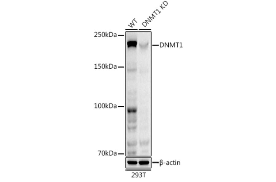 Western Blot - Anti-Dnmt1 Antibody [ARC51348] (A307587) - Antibodies.com