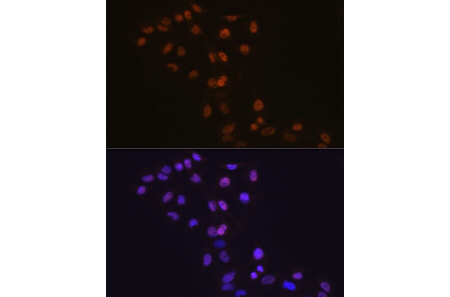 Immunofluorescence - Anti-Dnmt1 Antibody [ARC51348] (A307587) - Antibodies.com