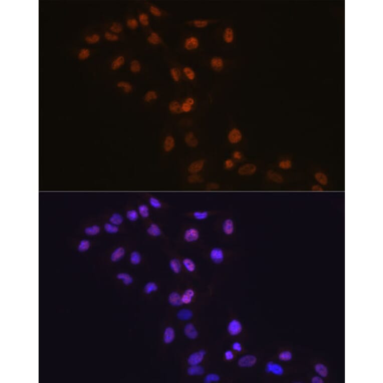 Immunofluorescence - Anti-Dnmt1 Antibody [ARC51348] (A307587) - Antibodies.com