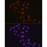Immunofluorescence - Anti-Dnmt1 Antibody [ARC51348] (A307587) - Antibodies.com