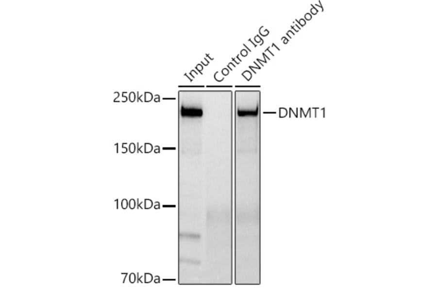 Western Blot - Anti-Dnmt1 Antibody [ARC51348] (A307587) - Antibodies.com