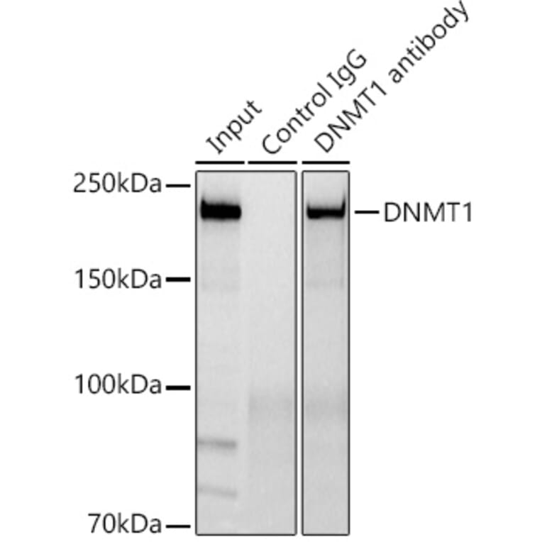 Western Blot - Anti-Dnmt1 Antibody [ARC51348] (A307587) - Antibodies.com