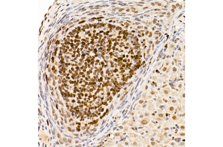 Chromatin Immunoprecipitation - Anti-Dnmt1 Antibody (A307587) - Antibodies.com