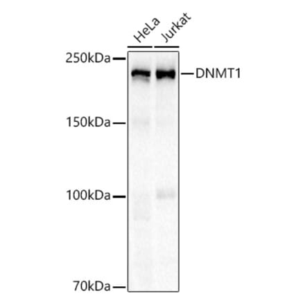 Western Blot - Anti-Dnmt1 Antibody [ARC51345] (A307588) - Antibodies.com