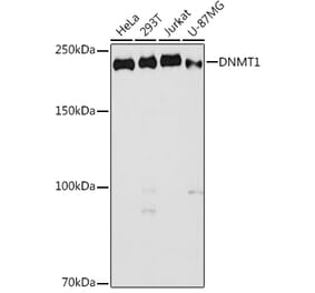 Western Blot - Anti-Dnmt1 Antibody (A307589) - Antibodies.com